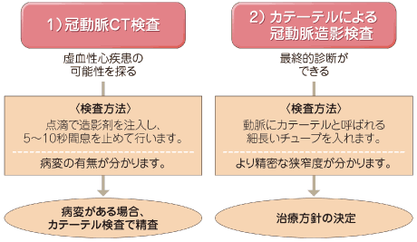 1）冠動脈CT検査、2）カテーテルによる冠動脈造影検査