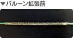 バルーン拡張前