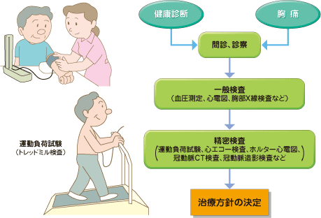 運動負荷試験(トレッドミル検査)