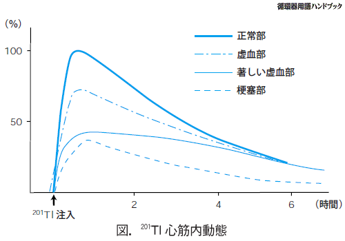 201TI心筋内動態