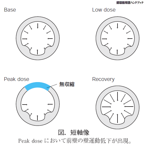 短軸像