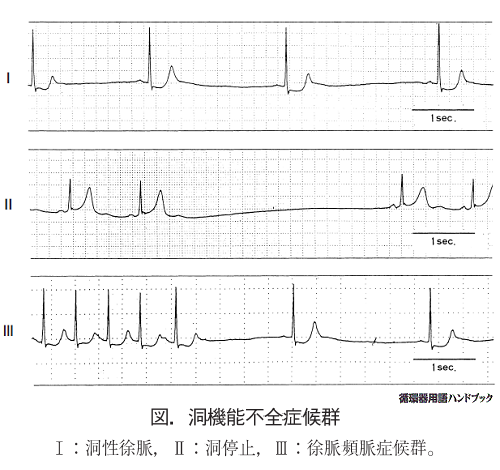 洞機能不全症候群