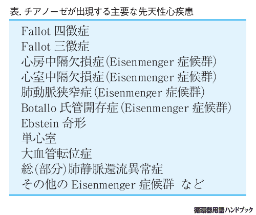 チアノーゼが出現する主要な先天性心疾患