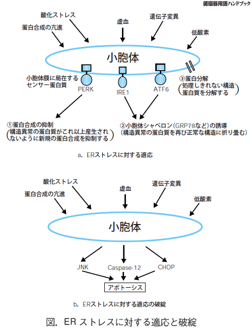 ERストレスに対する適応と破綻