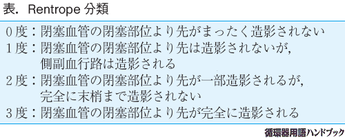Rentrope分類