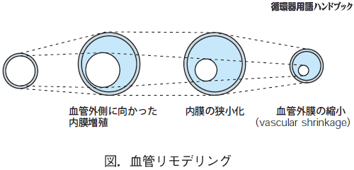 血管リモデリング