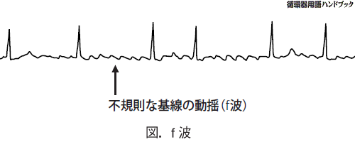 f波