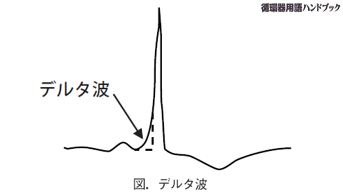 デルタ波
