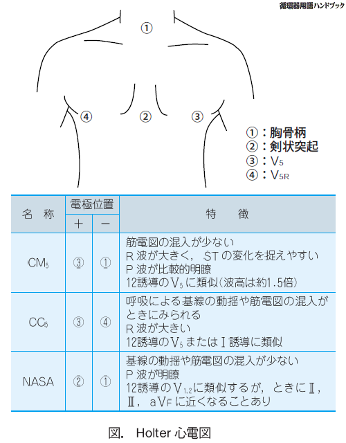 Holter心電図