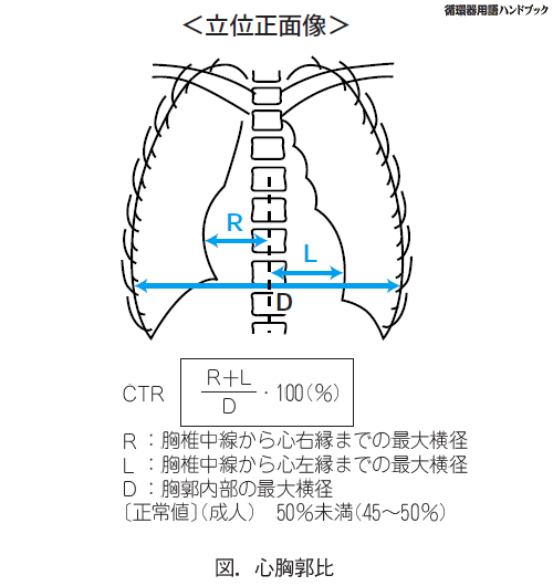 心胸郭比