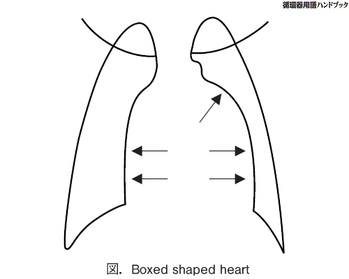 Boxed shaped heart