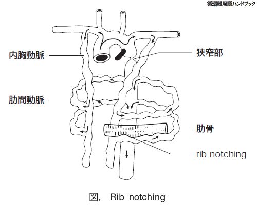Rib notching