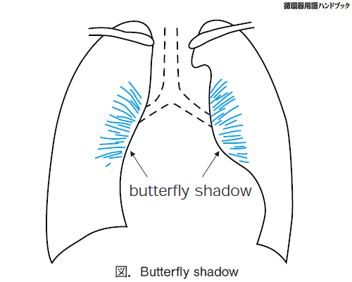 Butterfly shadow