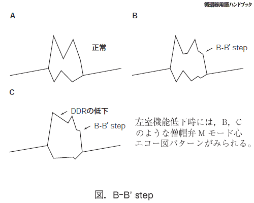 B-B' step