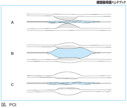 図.PCI