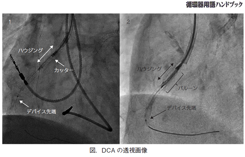 DCAの透視画像