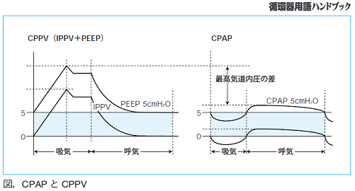 CPAPとCPPV