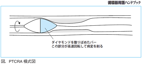 図.PTCRA模式図