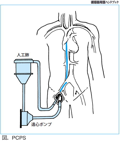 図.PCPS