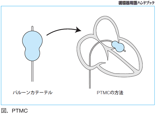 図.PTMC