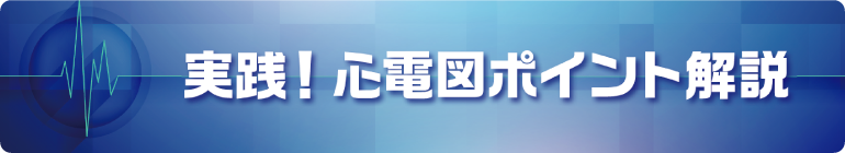 実践！心電図ポイント解説 タイトル画像