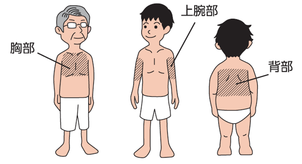 ビソノテープを貼る場所