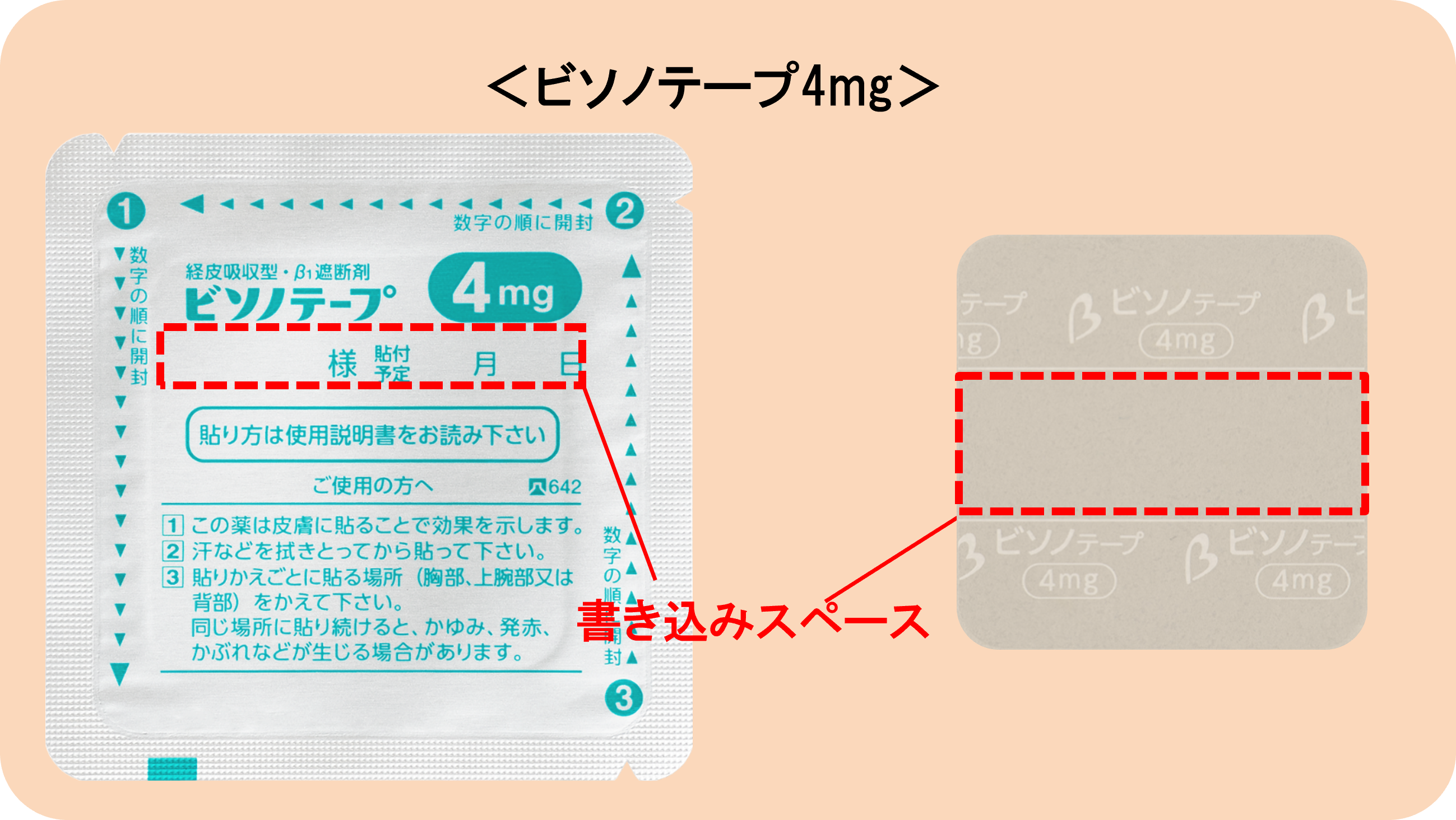 ビソノテープ4mgの外形