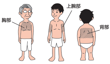 ビソノテープを貼る場所