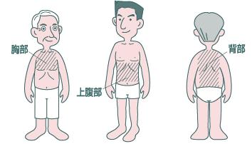 フランドルテープを貼る場所