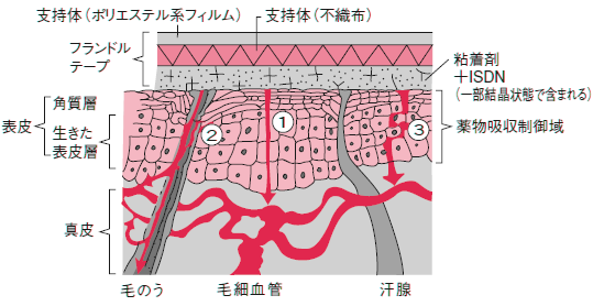 ISDNの吸収経路