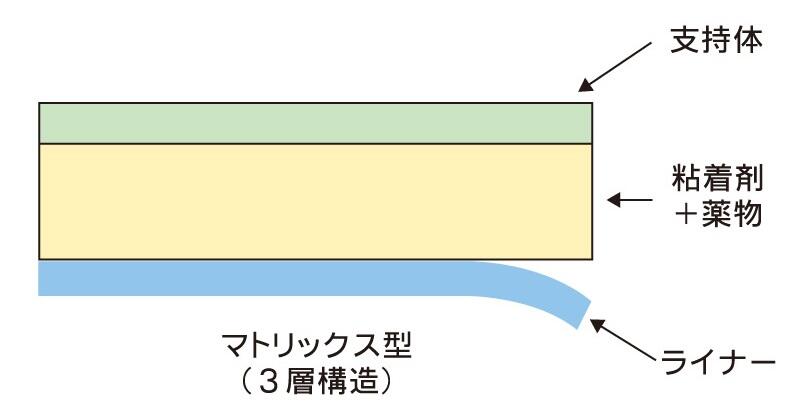 マトリックス型