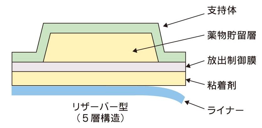 リザーバー型
