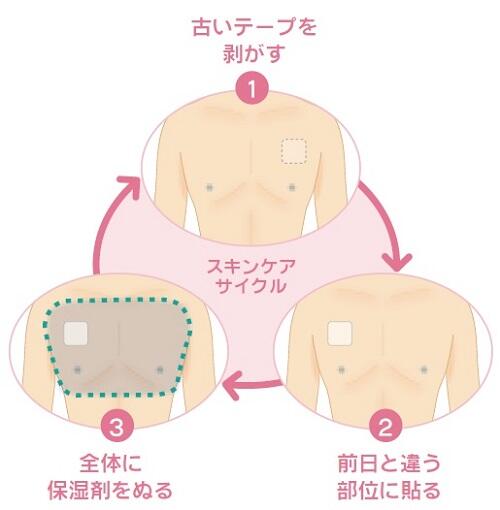 貼付部位
