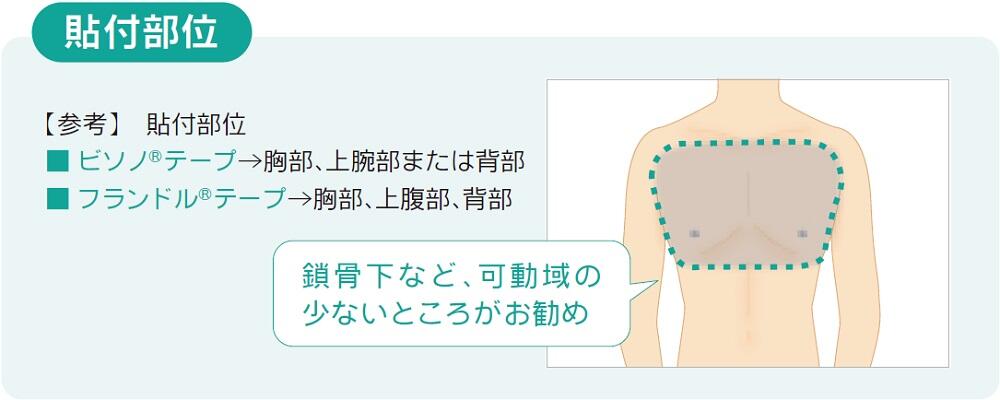 貼付部位