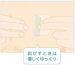 剥がし方