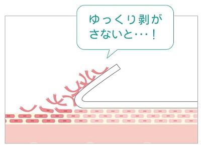 ゆっくり剥がさないと