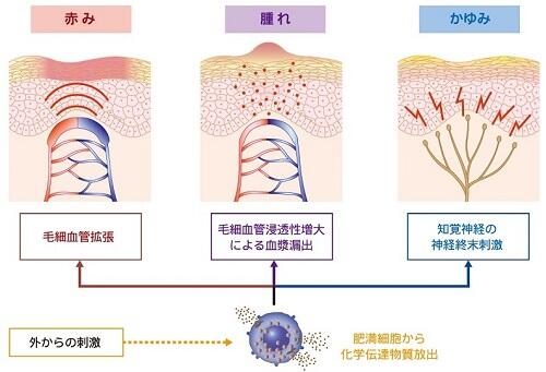 皮膚の赤みや腫れ、かゆみが生じるメカニズム