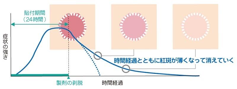 刺激性接触皮膚炎の時間経過による進展