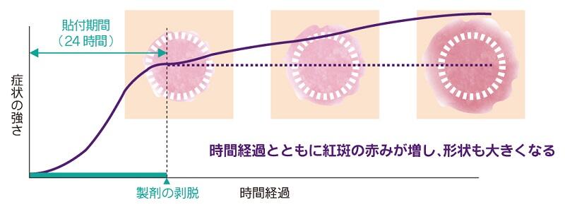 アレルギー性接触皮膚炎の時間経過による進展